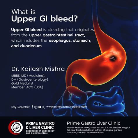 Upper GI Bleed Symptoms Causes Treatment More