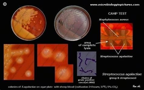 Streptococcus Agalactiae Group B Strep Streptococcus Agalactiae