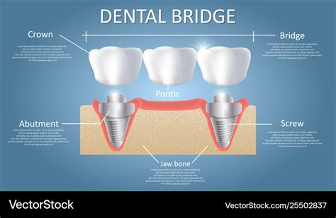 Dental Education Images