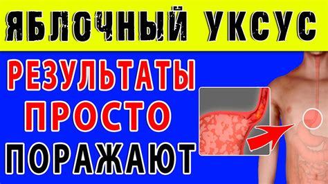 Что ДЕЛАЕТ ЯБЛОЧНЫЙ УКСУС с ОРГАНИЗМОМ 👍 Есть ли Полезные свойства у ...