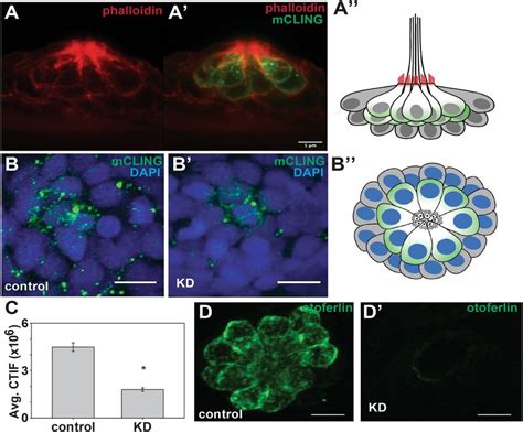 Depletion Of Otoferlin Results In Reduced Hair Cell Vesicle Recycling