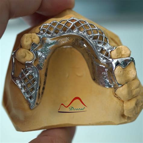 Bego Cast Partial Framework, High Quality Bego Cast Partial Framework ...