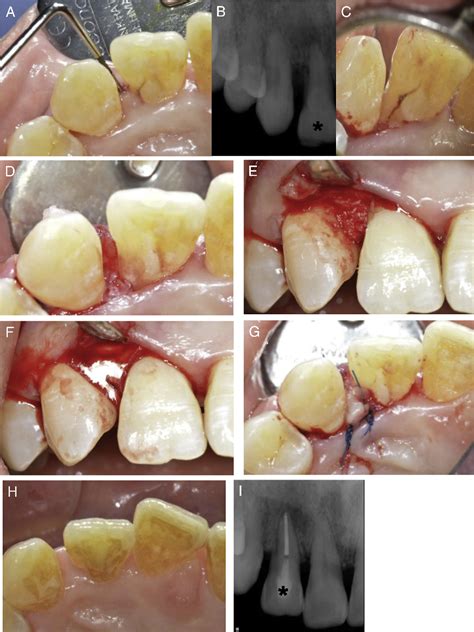 Figure From Collaborative Management Of Combined Periodontal