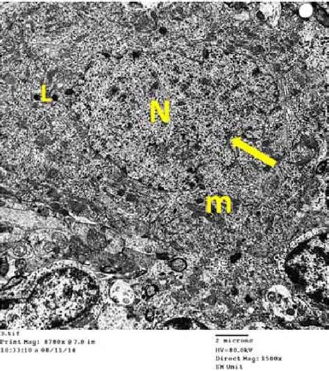 An Electron Micrograph Of An Ultrathin Section In The Cerebellar Cortex