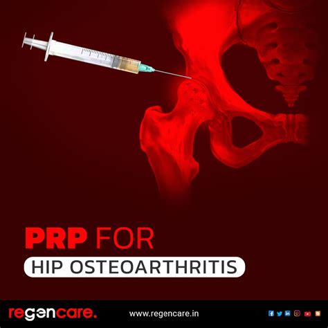 Why Prp Injection Is A Practical Remedy For Hip Osteoarthritis Regencare