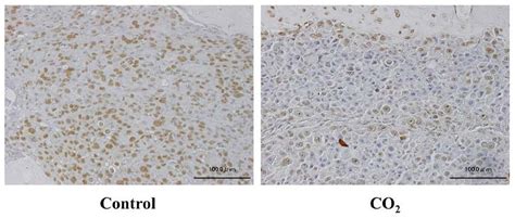 Immunohistochemical staining for HIF 1α in tibiae from both the CO 2