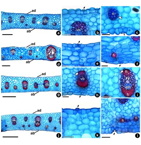 Cross Sections Of The Leaf Blades Of Cyrtopodium Blanchetii A C C Download Scientific