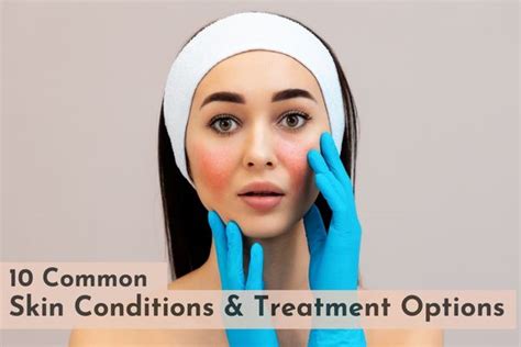 10 Common Skin Conditions & Treatment Options - SkinQure