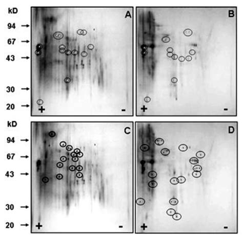 Two Dimensional Gel Electrophoresis Of Total Protein Extracted From Download Scientific Diagram