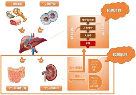 痛风≠高尿酸！他们之间的关系其实是这样的 知乎