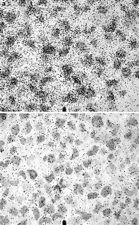 Representative Autoradiography Images Of Hematoxylinstained Cultured