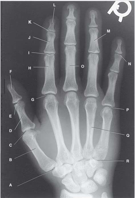 Right hand anatomy Diagram | Quizlet