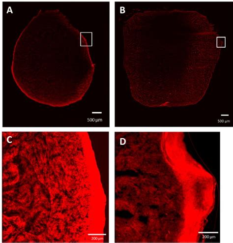 Confocal Imaging Of An Ectopic Tumor At 24 H After The Administration