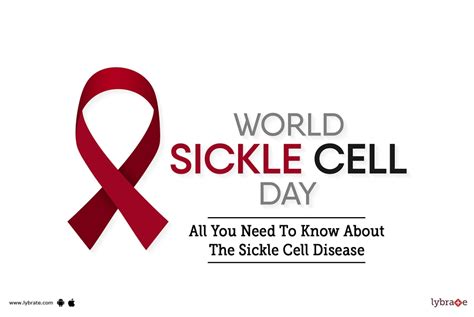 World Sickle Cell Day All You Need To Know About The Sickle Cell