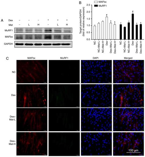 Matrine Improves Skeletal Muscle Atrophy By Inhibiting E3 Ubiquitin