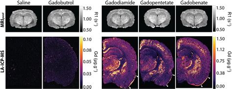 Gadolinium Deposition In The Rat Brain Measured With Quantitative Mri