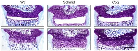 Microdissection Of Growth Plate Hypertrophic Zones From Wildtype And