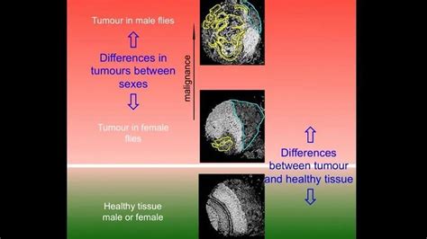 Genes Responsible For Sex Related Differences In Cancer Aggressiveness