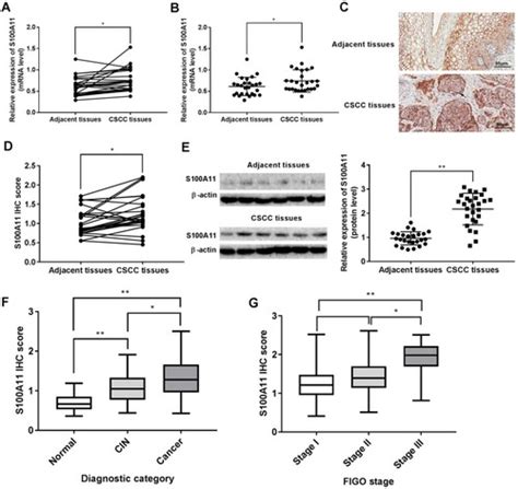 Full Article S Calcium Binding Protein A S A Promotes The