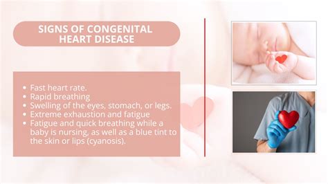 Ppt Know About Congenital Heart Disease Powerpoint Presentation Free