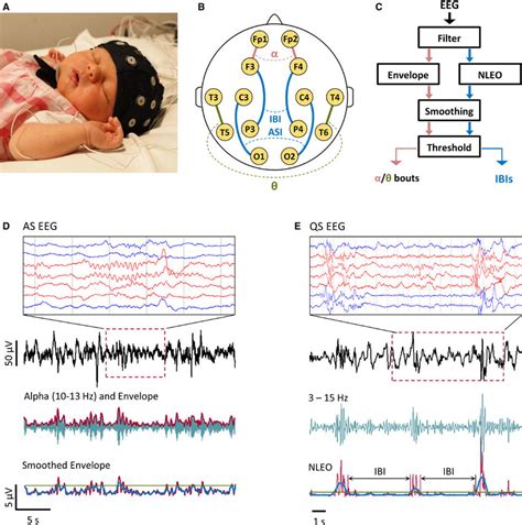 How Do They Do An Eeg On A Baby Vesta Valentin