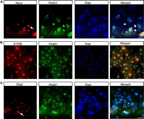 Frontiers The Neural Stem Cell Properties Of Pkd L Cerebrospinal