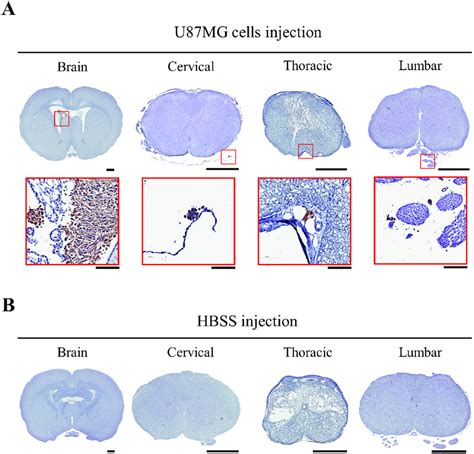 Immunohistochemical Detection Of Human Cells Each Region Of The Cns In