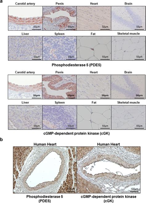 Sildenafil Reduces Neointimal Hyperplasia After Angioplasty And