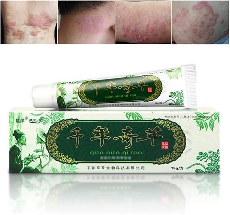 Amazon Pcs Natural Chinese Herbal Eczema Psoriasis Creams