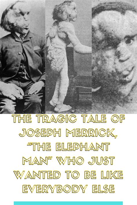 The Tragic Tale Of The Elephant Man Who Just Wanted To Be Like