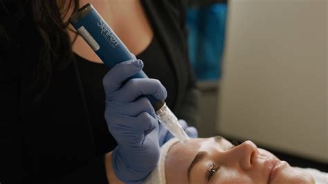 Skinpen Microneedling Exosomes Elevate Your Microneedling