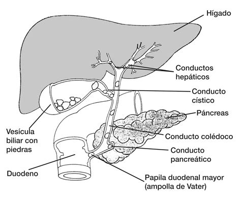 Sistema Biliar Incluyendo La Ves Cula Con C Lculos Biliares Media