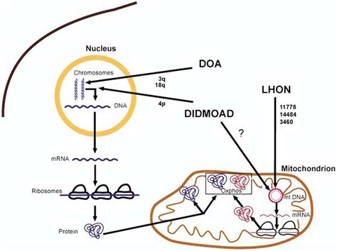 Autosomal Dominant Optic Atrophy Eyewiki