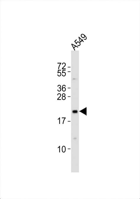 Rabbit Anti Ereg Polyclonal Antibody C Term Absin