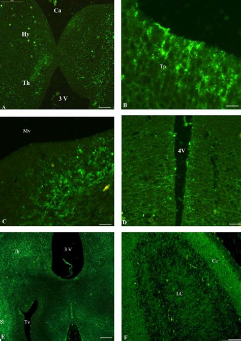 Immunofluorescence Photomicrographs Illustrating The Distribution Of