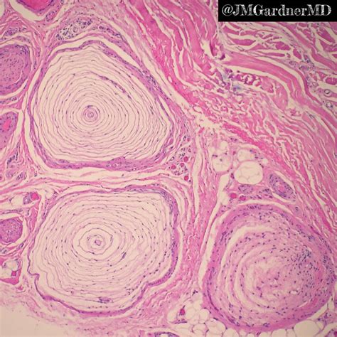 Pacinian Corpuscle