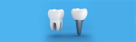 Dental Implants Procedure Risks And Benefits