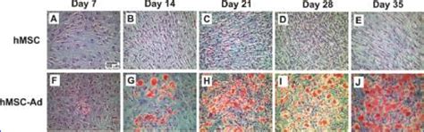 Adipogenic Differentiation Of Human Mesenchymal Stem Cells HMSCs In