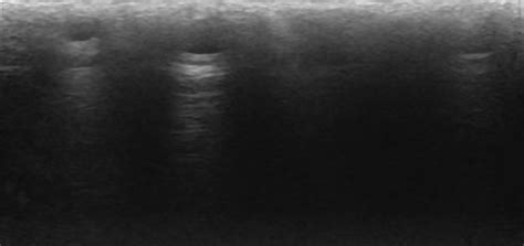 july  ultrasound cases