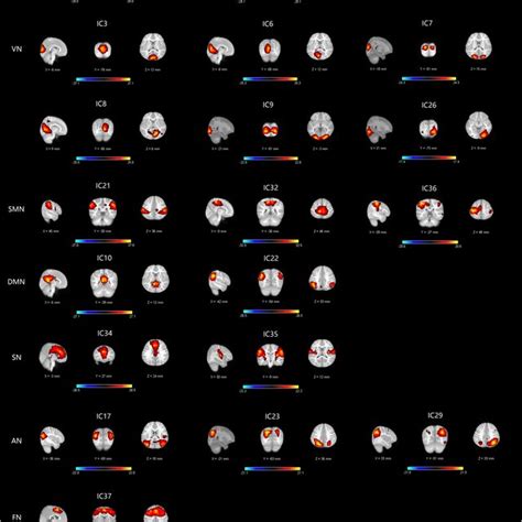 Functional Relevant Restingstate Networks RSNs The Spatial Maps Of