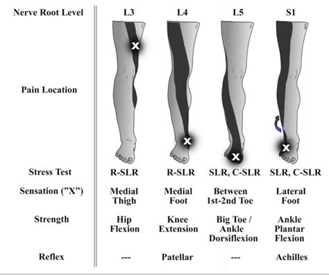 Get Back: A Runner’s Guide to Low-Back Pain – iRunFar