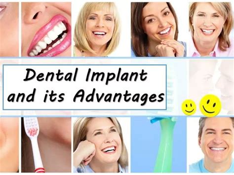 PPT Dental Implant And Its Advantages PowerPoint Presentation Free