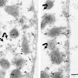 Low Power Electron Micrograph Showing Fairly Well Preserved Cellular