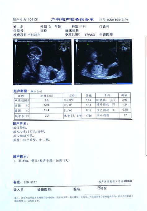 如何看懂b 超报告单