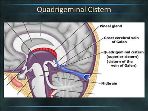 Ppt Brain Cisterns Powerpoint Presentation Free Download Id