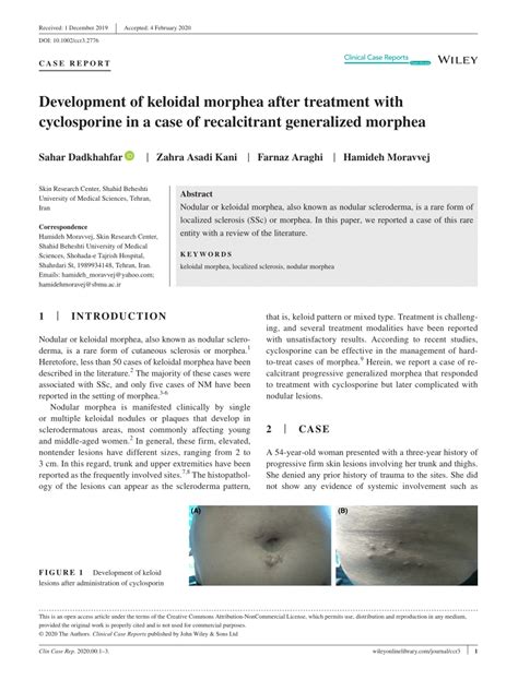 Pdf Development Of Keloidal Morphea After Treatment With Cyclosporine