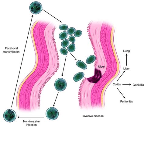 2 Noninvasive Versus Invasive Amebiasis During Noninvasive Disease Download Scientific