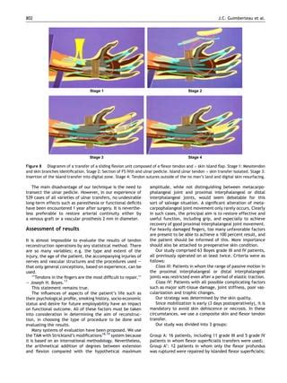 A Fresh Look At Vascularized Flexor Tendon Transfers Pdf