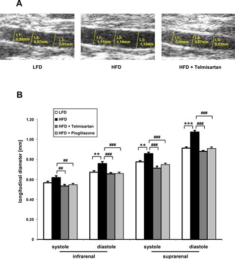 Measurements Of The Aortic Dimensions In Lfd And Hfd Mice A Axial