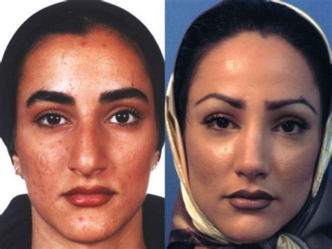 Persian Women Nose